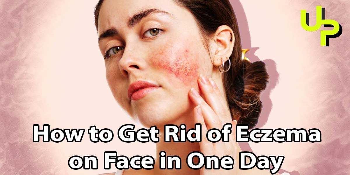 How to Get Rid of Eczema on Face in One Day - Utilize Point