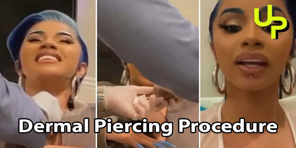 Dermal Piercing Procedure
