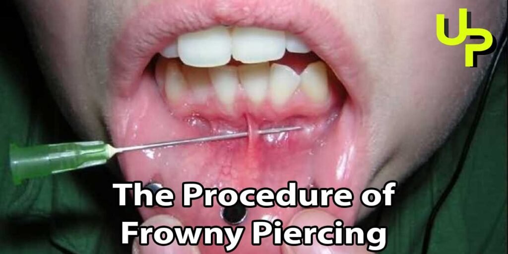 The Procedure of Frowny Piercing